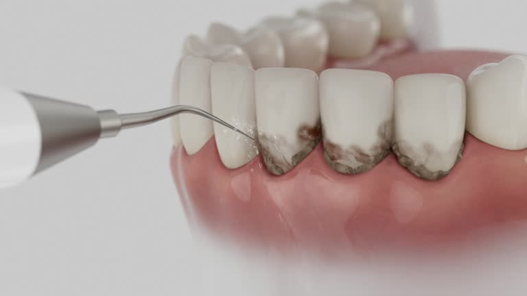 Reliable Dental Implants contractor in Ishpeming, MI by Smile Center Dentistry